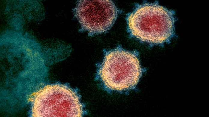 coronavirus puede sobrevivir a más de 60 grados - noticiero de venezuela
