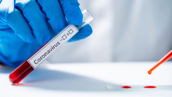 Coronavirus es de origen natural - NDV