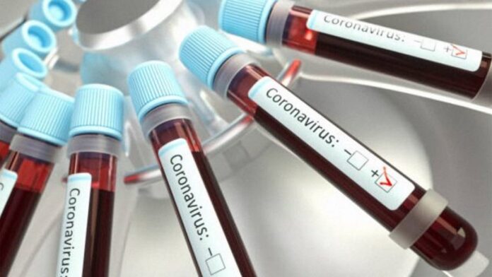 Rusia lanzará medicamento para coronavirus - Noticiero de Venezuela