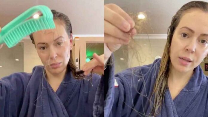 Alyssa Milano pierde el cabello - NDV