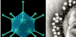 hepatitis infantil