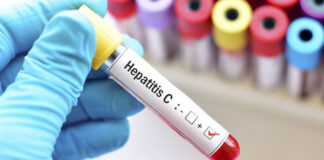 argentina hepatitis aguda desconocida