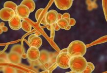 Candida auris