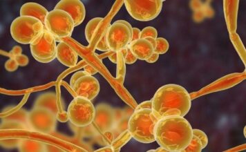 Candida auris