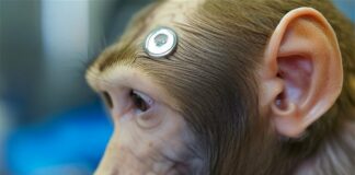 Musk Neuralink muerte de monos-ndv